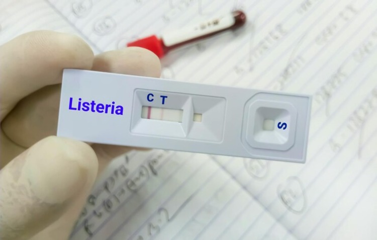 Test rapido Listeria, sintomi della listerosi e prevenzione